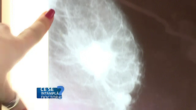 Cum să vă protejați glandele mamare încă din tinereţe