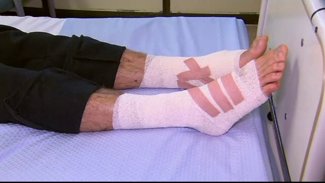 australia, atac, mare, crustacee