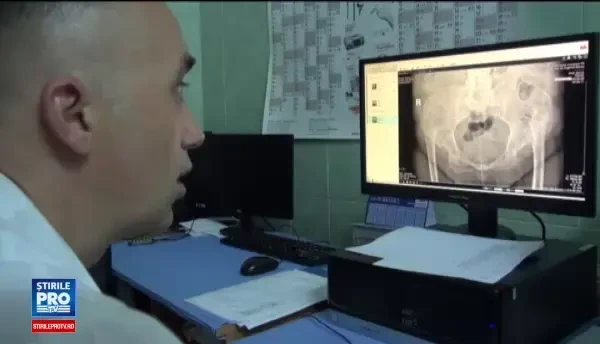 Operație în premieră în cazul unei femei de 68 de ani din Bacău