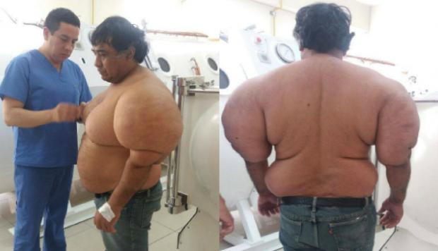 Corpul i s-a deformat și are dureri înfiorătoare. Ce s-a întâmplat cu bărbatul