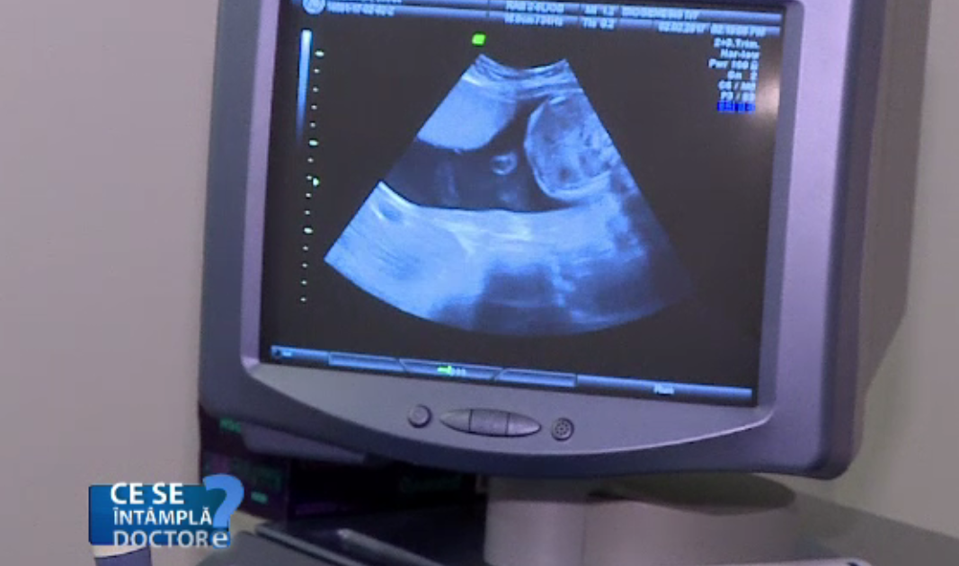 Pilulele anticoncepţionale nu reduc capacitatea fertilă. Ce spun medicii despre fertilitate