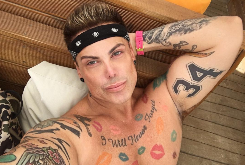 Dornic să atingă perfecțiunea, a rămas cu o problemă uriașă în urma unei rinoplastii