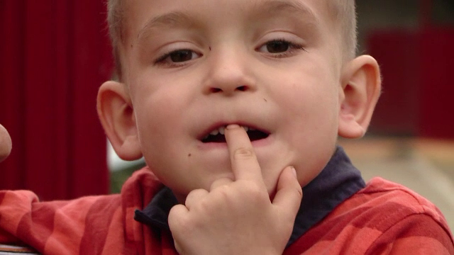 În România, 1 copil din 10 nu s-a spălat niciodată pe dinți