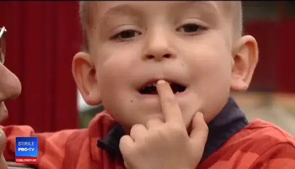 În România, 1 copil din 10 nu s-a spălat niciodată pe dinți