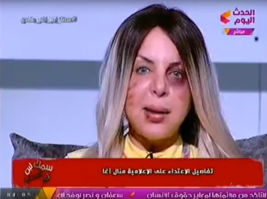 O cunoscută prezentatoare din Egipt a apărut la TV cu urme de violenţă pe faţă