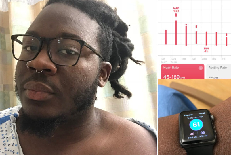 Un ceas inteligent i-a salvat viața unui tânăr. Medicii i-au descoperit ceva grav