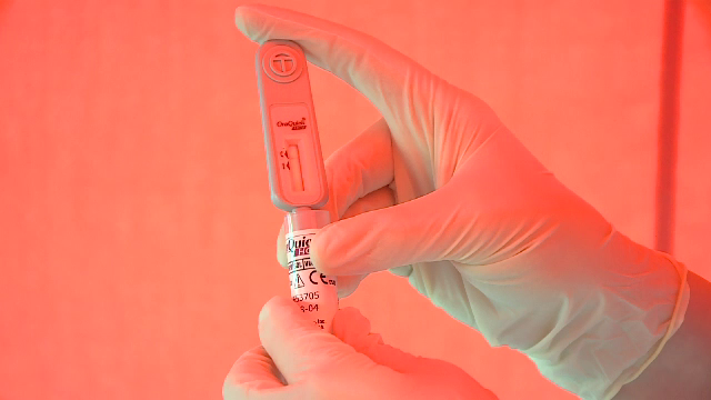 Ce trebuie să știm despre Hepatita C, boala de care suferă 600.000 de români