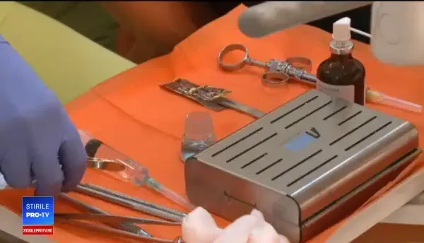 Cariile netratate pot duce la cancer sau pot provoca un infarct miocardic. Romanii evita mersul la dentist