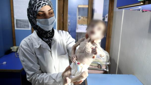 Imaginea tulburătoare a unui copil sever înfometat în Siria. Pruncul cântărea mai puțin de 2 kg