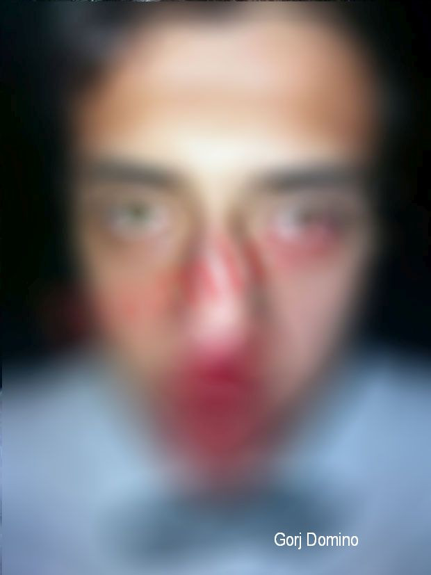 Un ospătar de 18 ani din Gorj a fost bătut la o nuntă de ginere. FOTO