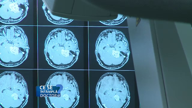 Divorțul și pierderea locului de muncă. Cum trebuie să abordați aceste evenimente stresante