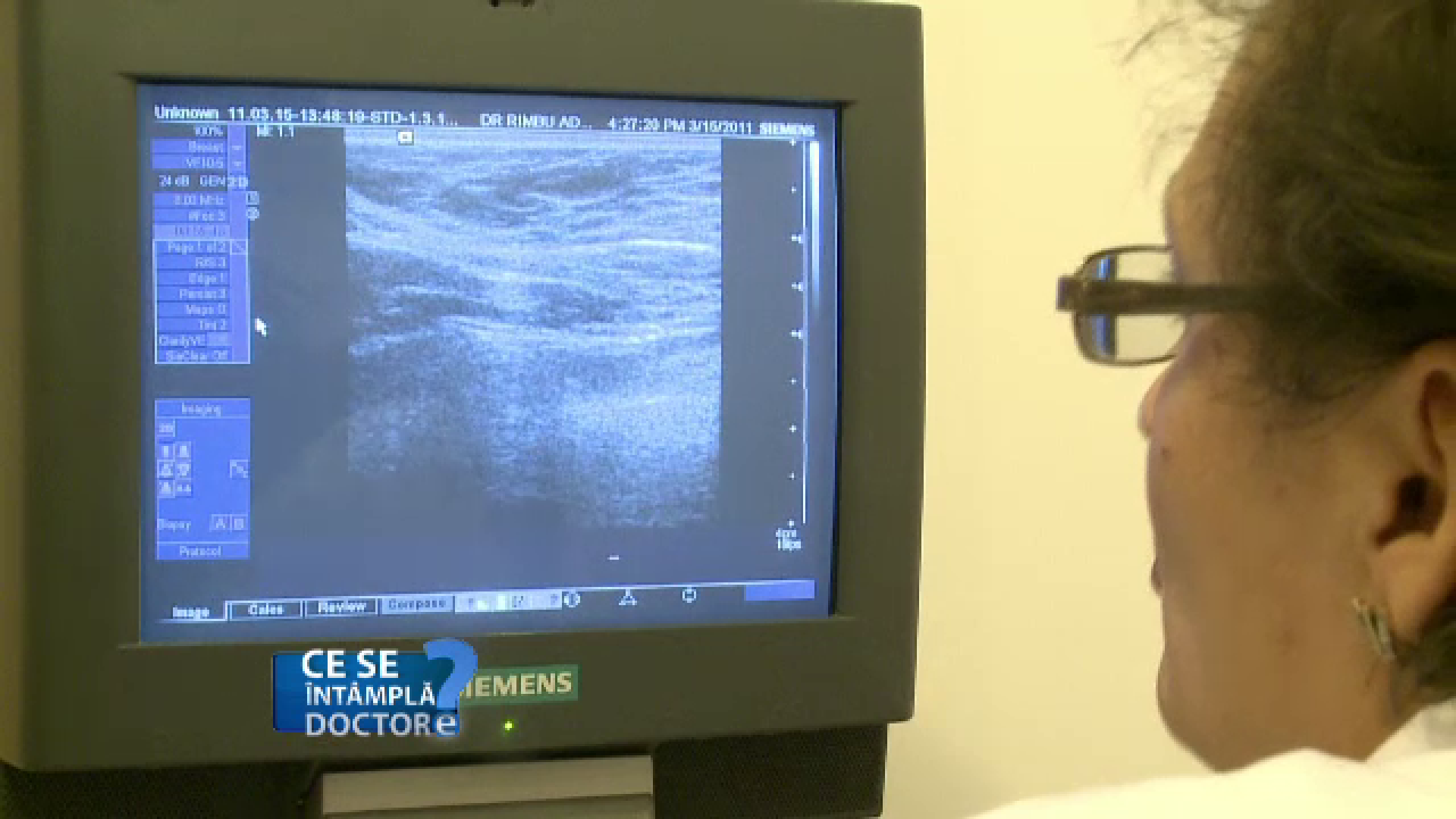 De ce este important să faceți o investigație imagistică a sânului în fiecare an