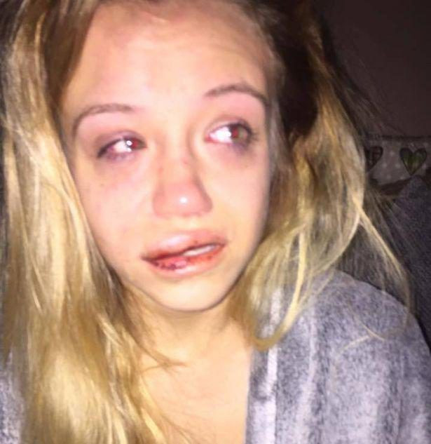 Bătută crunt în propria casă de o bandă de hoți, în timp ce părinții erau în vacanță