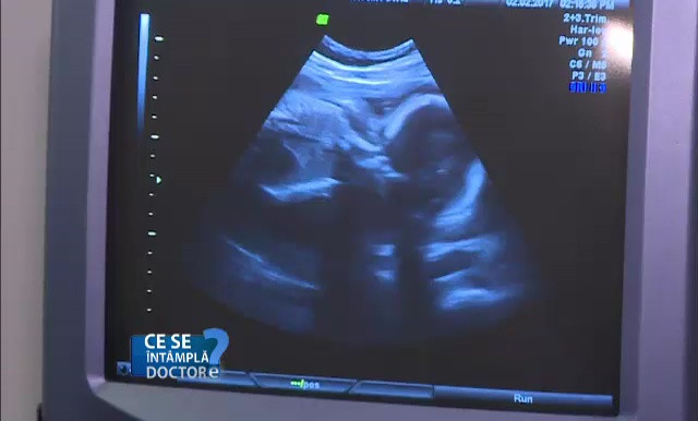 De ce este important ca mamele să facă teste în timpul sarcinii