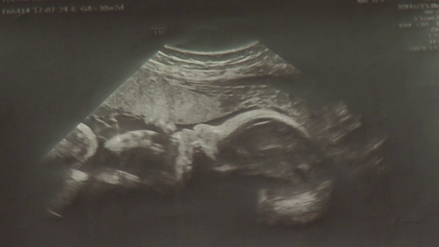 O viitoare mamă s-a luptat cu CAS, pentru a-și salva fetița: Legal, copilul nu avea identitate