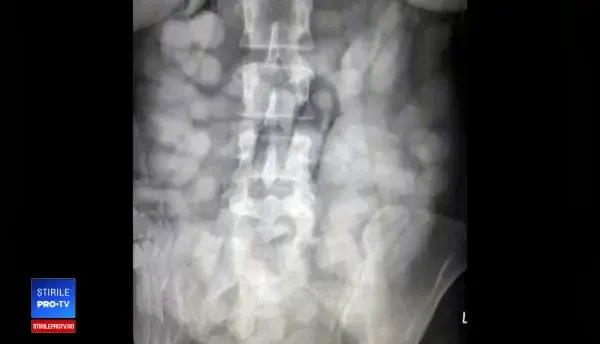 Doi brazilieni, reţinuţi pe Aeroportul Otopeni. Câtă cocaină aveau în stomac