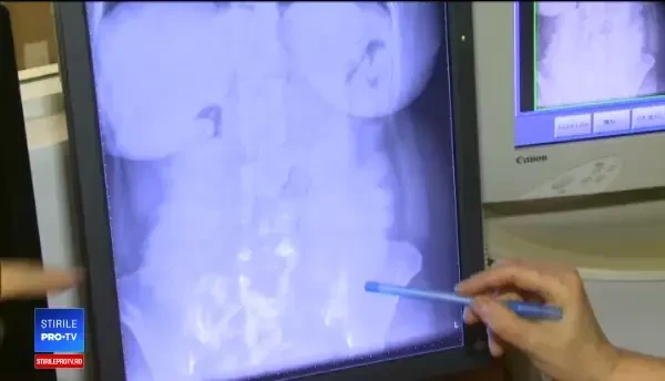 Greşelile comise de brazilienii prinşi cu două kg de cocaină în stomac, pe Aeroportul ”Henri Coandă”