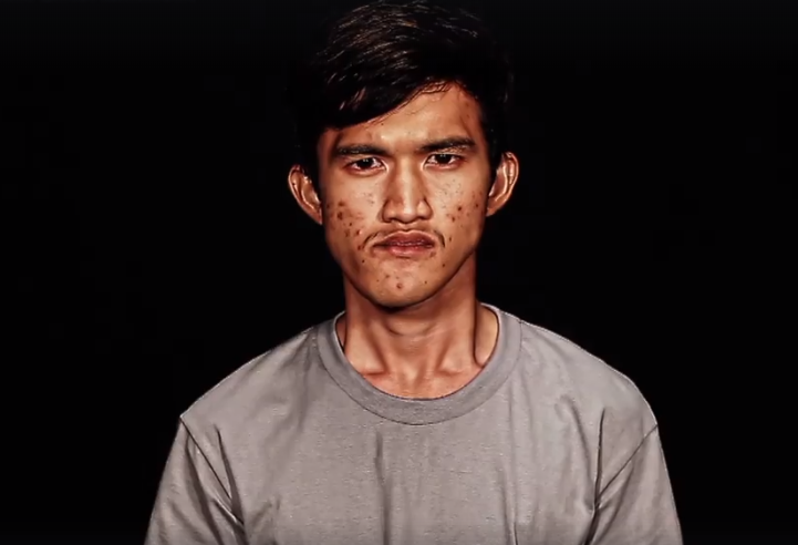 O femeie nu-și recunoaște fiul, după ce a fost supus unor operații estetice drastice. Reacția ei. VIDEO