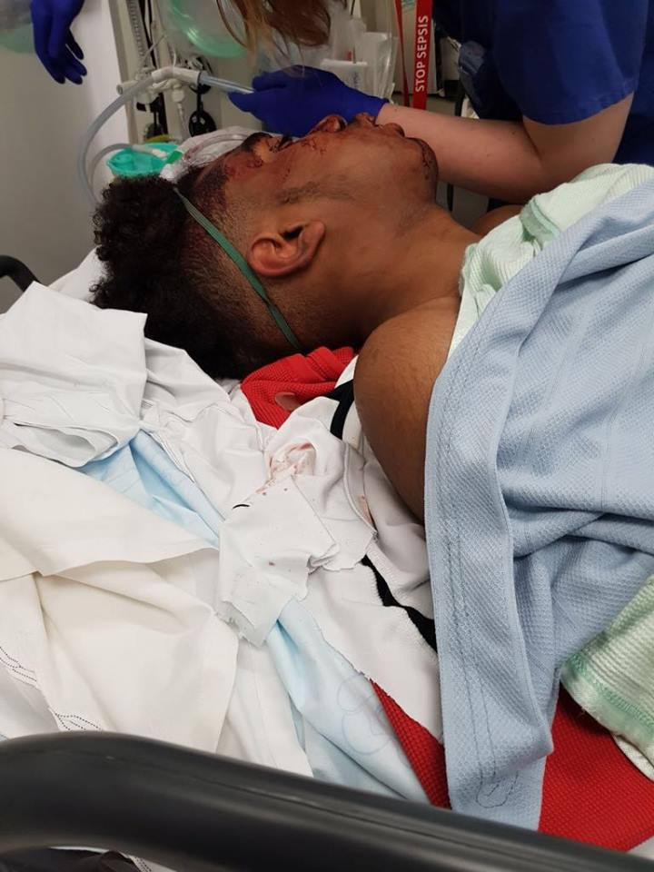 Adolescent de culoare, victimă a brutalității poliției. Oamenii legii: A căzut de pe bicicletă