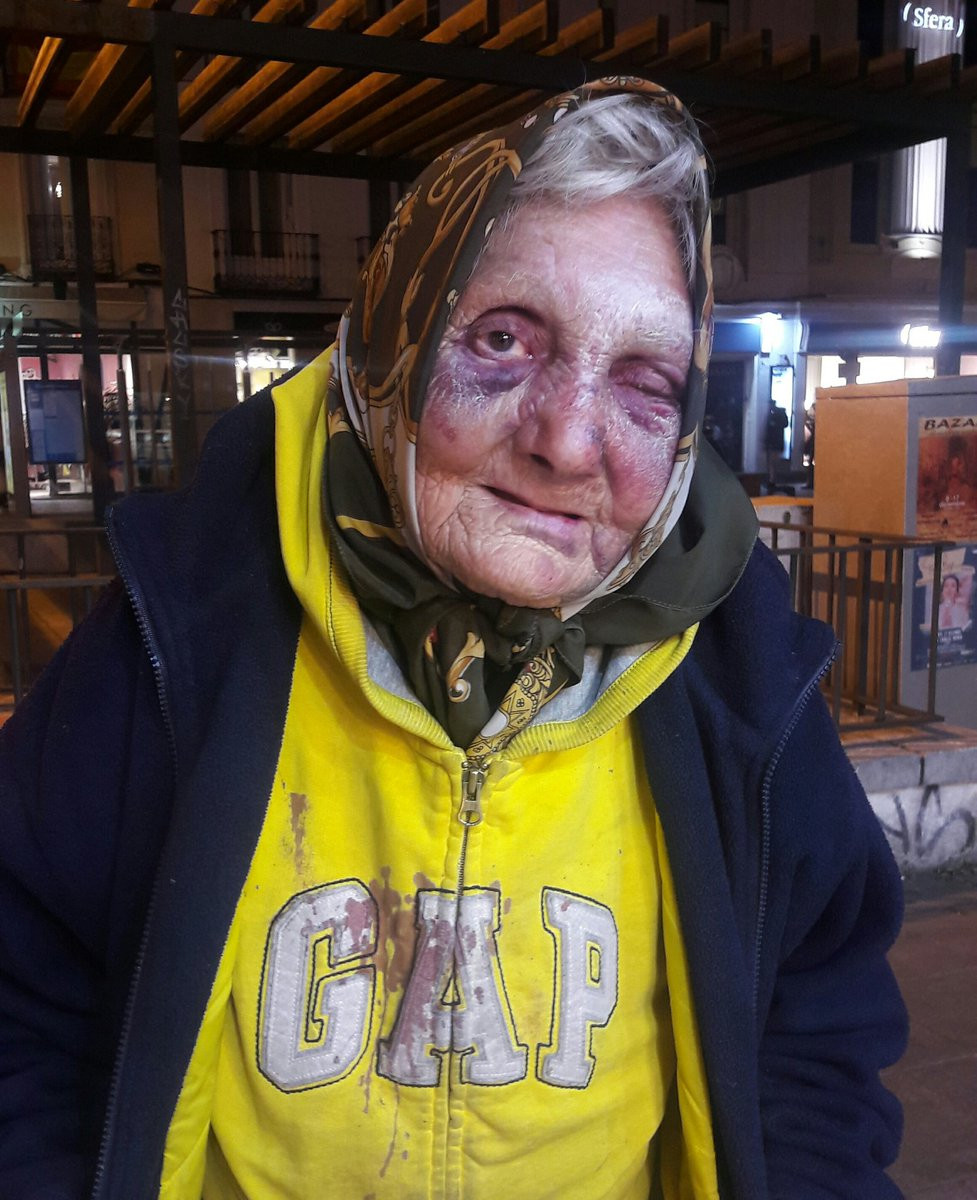 Bătrână fără adăpost din România desfigurată în urma unui atac rasist, la Madrid