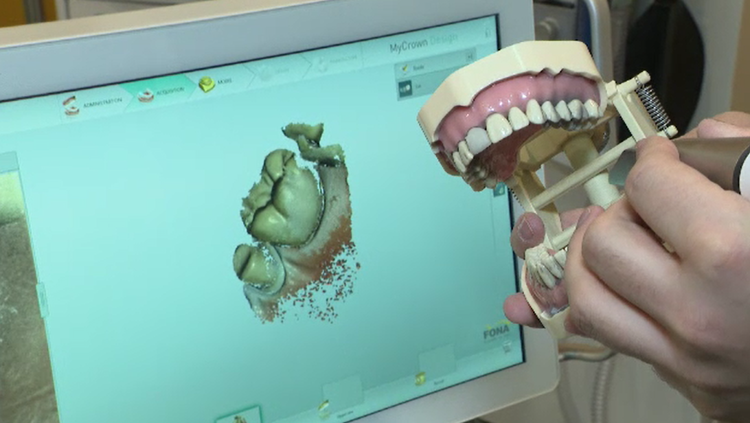 Târg de medicină dentară. Dispozitivul care face un dinte pe oră