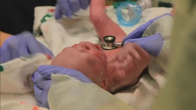 Premieră medicală, în SUA. O femeie cu uterul transplantat a devenit mamă