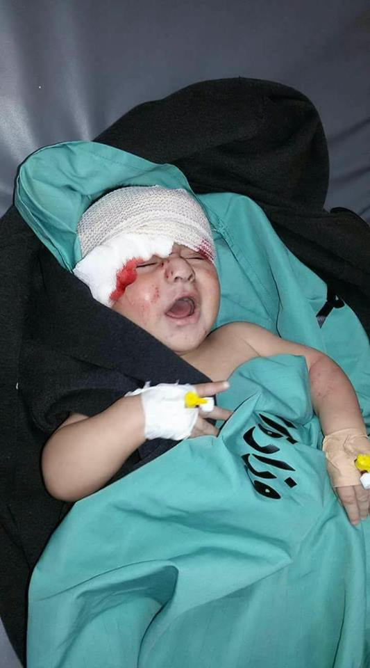 Bebeluș de șase luni, grav rănit în urma atacului cu avioane din Fâșia Gaza