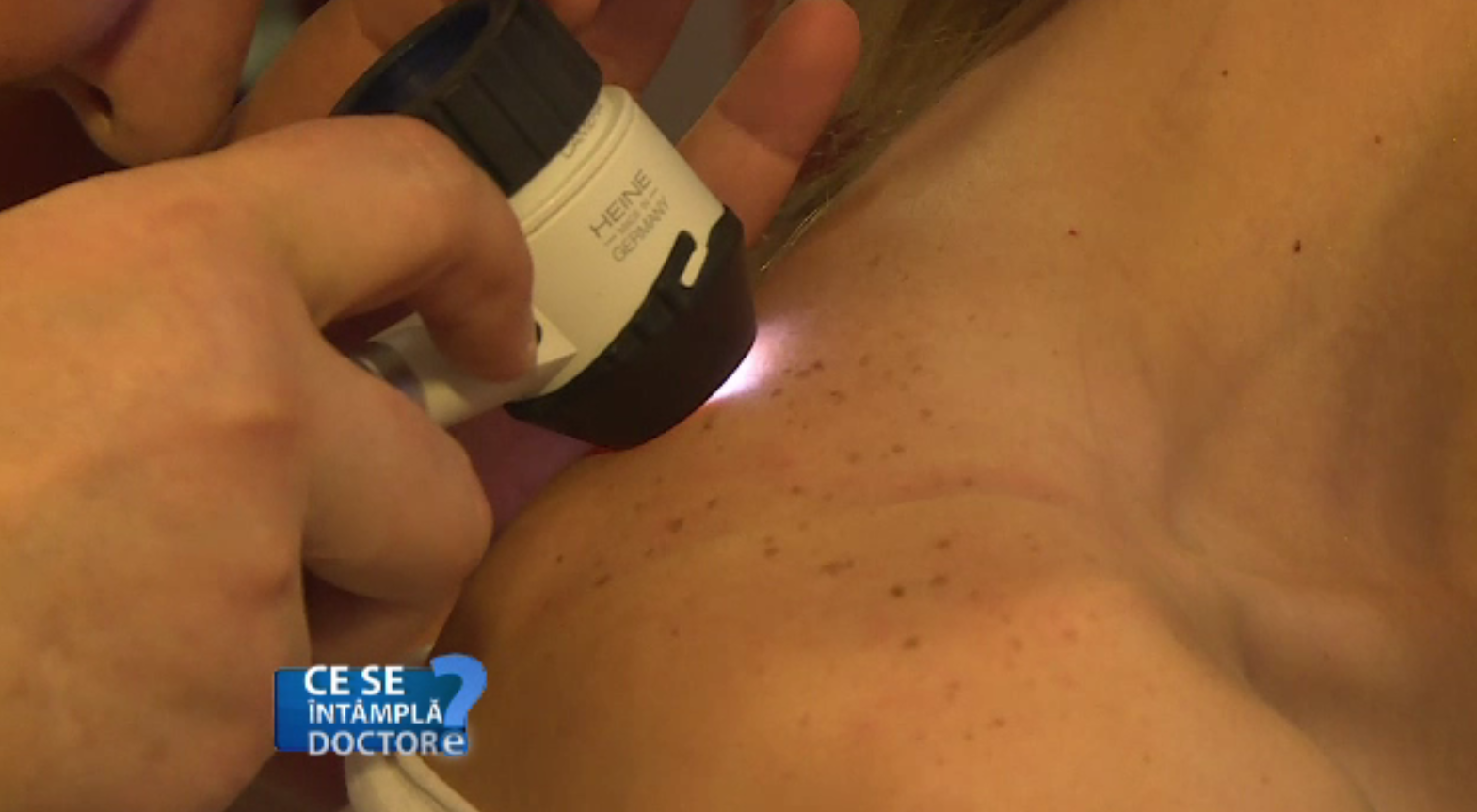 CSID. Terapia cu cortizon, soluția pentru cele mai frecvente afecţiuni dermatologice