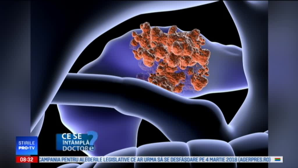 Pancreasul, prima victimă a exceselor alimentare. Cum ajunge să "dea rateuri"