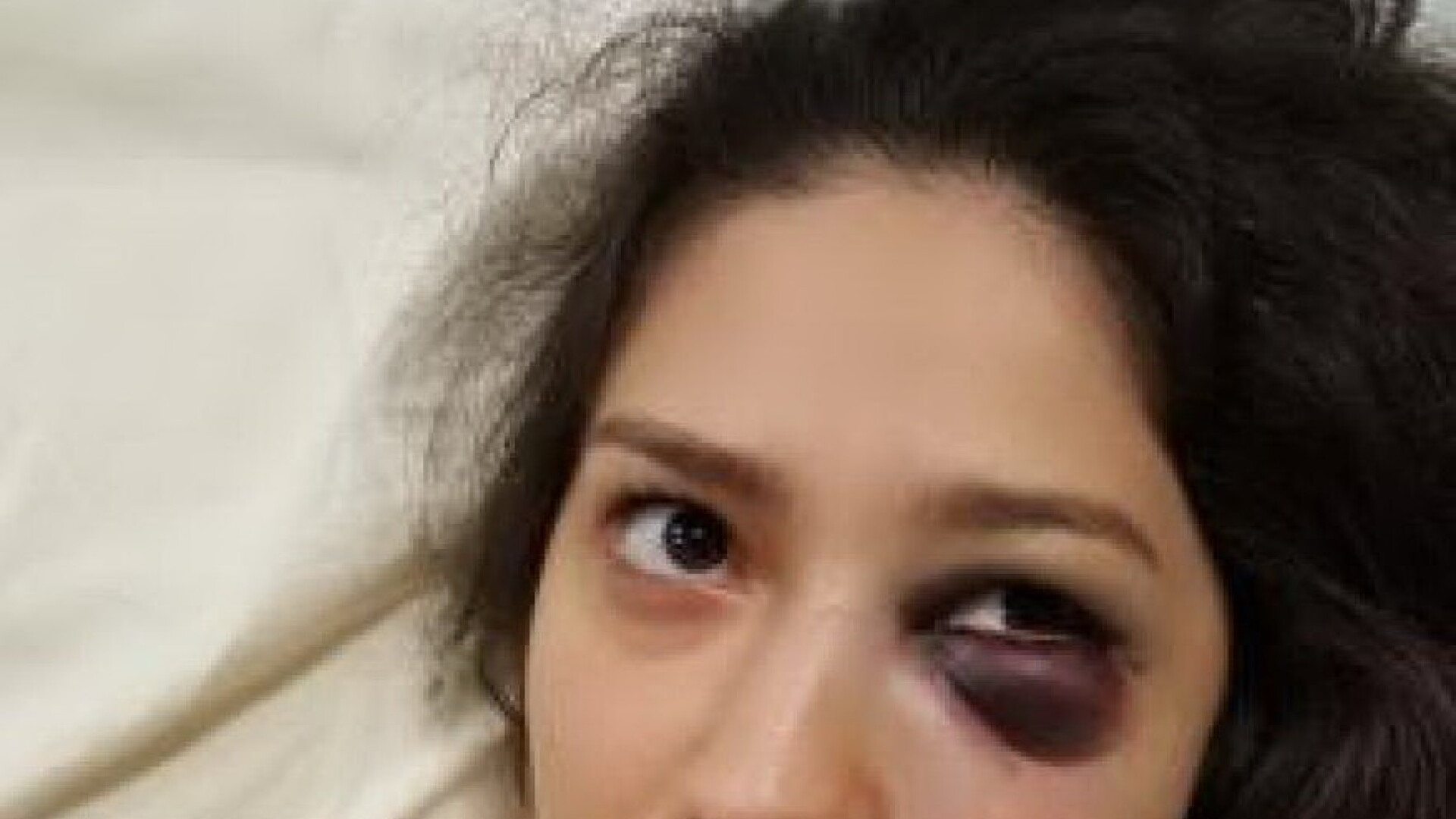 Tânără desfigurată în bătaie, într-un club din Oradea, pentru că a refuzat avansurile a doi bărbați