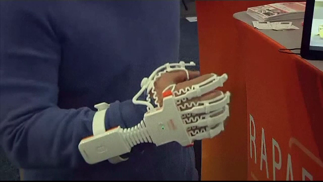 CES 2018. Cum arată mănușa inteligentă pentru recuperare