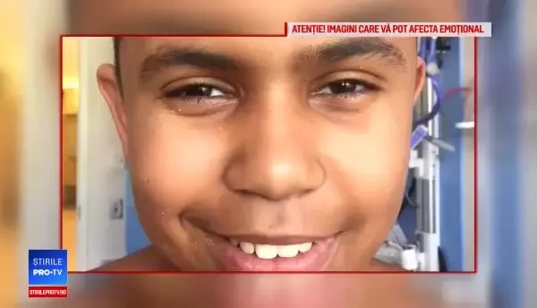 Craniul unui băiat de 13 ani, perforat de un șurub, în timp ce construia o căsuță în copac