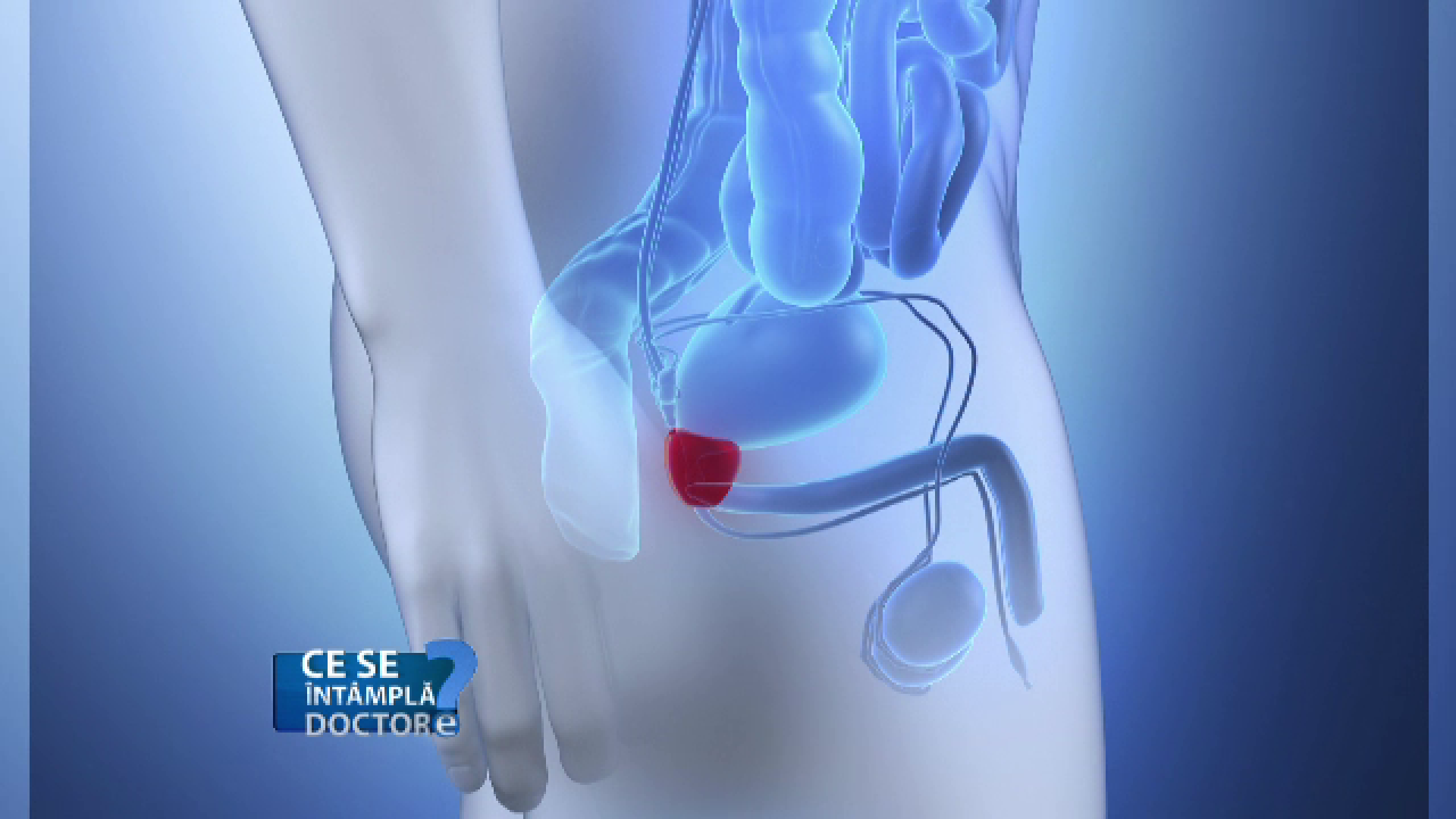 Analiza PSA ajută la depistarea cancerului de prostată