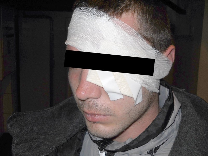 O femeie a pus doi bărbați să îl snopească în bătaie pe fostul iubit, apoi s-a împăcat cu el