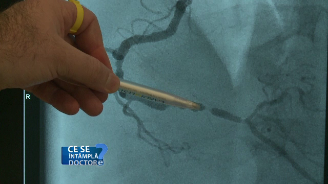 Vasele de sânge se contractă de la o singură țigară. Ce se întâmplă, apoi, în organism