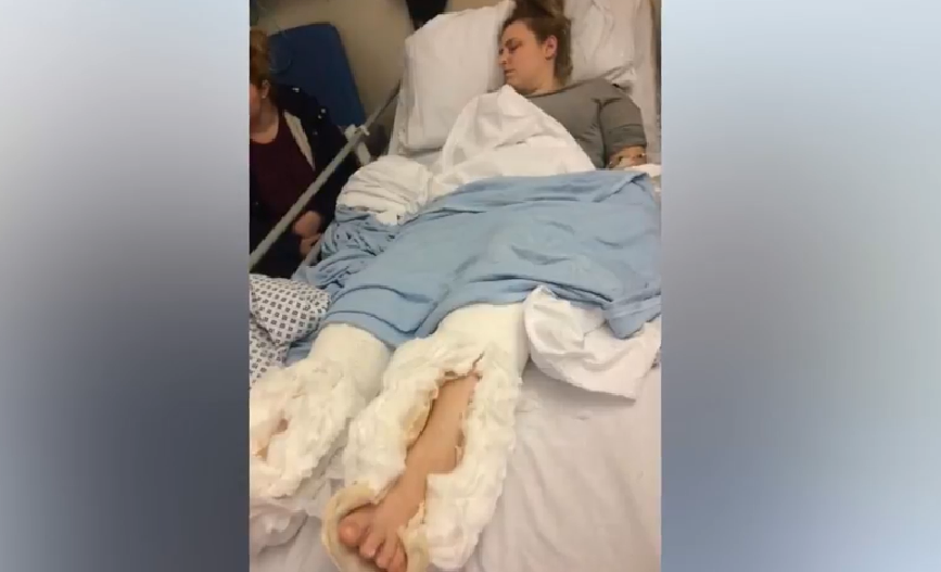 O femeie a fost nevoită să ia un taxi, după ce și-a rupt ambele glezne. Trei ore a așteptat o ambulanță