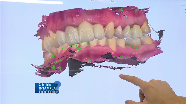 Apariția bolii paradontale, legată de starea permanentă de stres