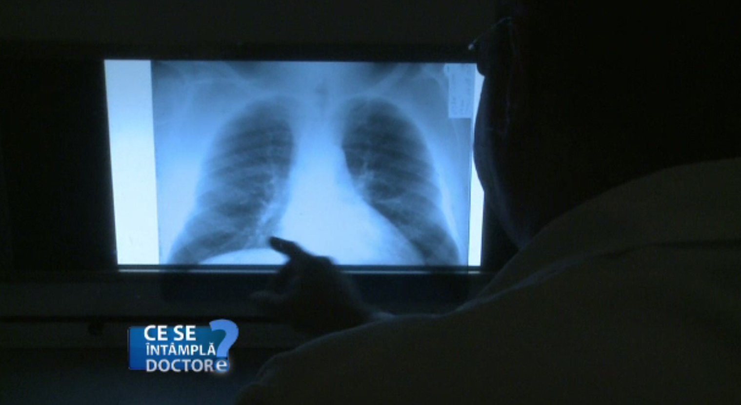 Motivele ascunse ale tusei și expectorației în exces