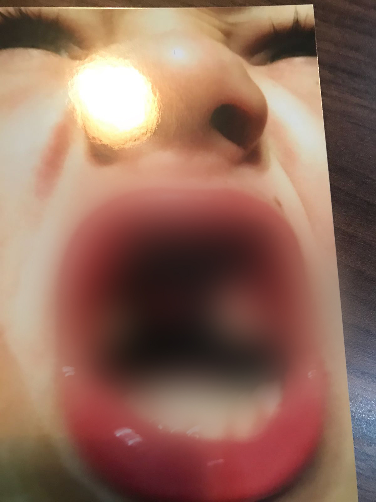 Primele imagini cu băiatul de 8 ani care și-a pierdut dinții la Therme