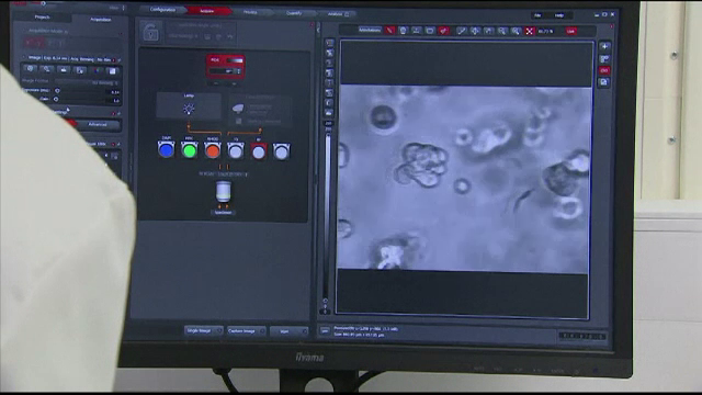 Cercetătorii cresc tumori în laborator pentru a îi trata pe bolnavii de cancer