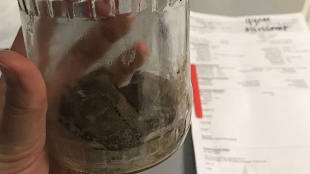 nastere, marea britanie, pansamente,