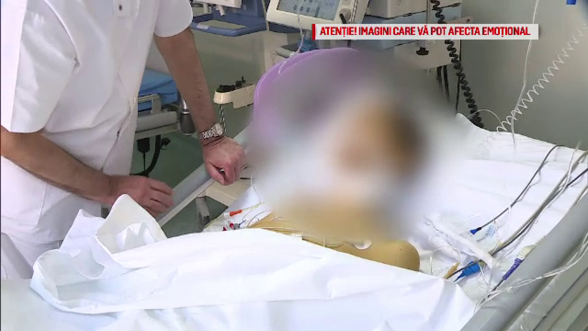 Numărul transplanturilor a scăzut drastic din cauza scandalurilor din Sănătate. Cazul lui Sergiu