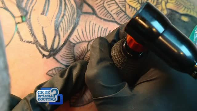 Tatuaje cu trimitere de la medic. În ce situaţii sunt recomandate