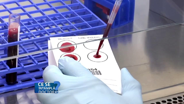 Analiza de sânge care trebuie făcută o dată pe an. Informațiile vitale oferite de hemoleucogramă