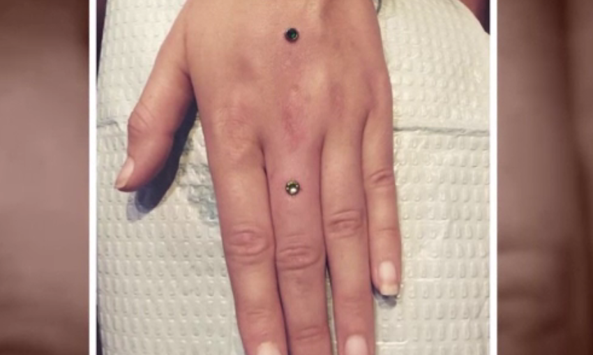 Nou trend în SUA. Tinerii își încrustează pietre preţioase în loc de inelul de logodnă