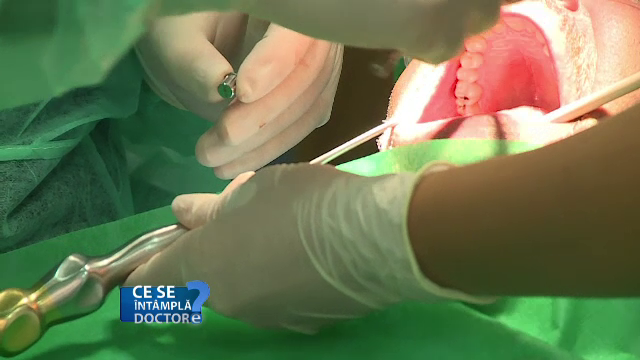 Boala parodontală, evoluție rapidă la tineri. Semnele la care trebuie să fim atenți