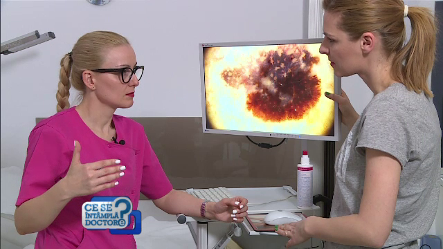 O fotografie în fiecare lună pentru leziunile pielii. Pozatul aluniţelor sau petelor, metoda excelentă de monitorizare