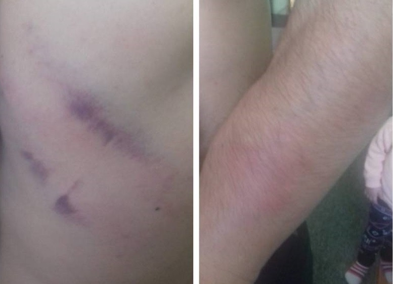 Un tânăr din Ocna Mureș susține că a fost agresat de un polițist aflat în timpul liber