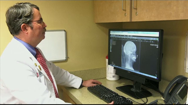 Cercetătorii au dezvoltat un anticorp care i-ar putea trata pe bolnavii de Alzheimer