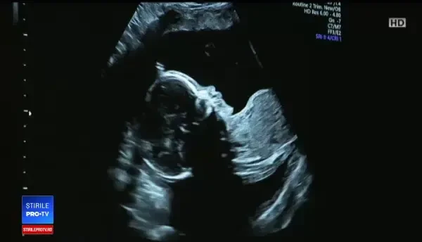 Cursuri de pregătire pentru medicii români, pentru a preveni mortalitatea infantilă